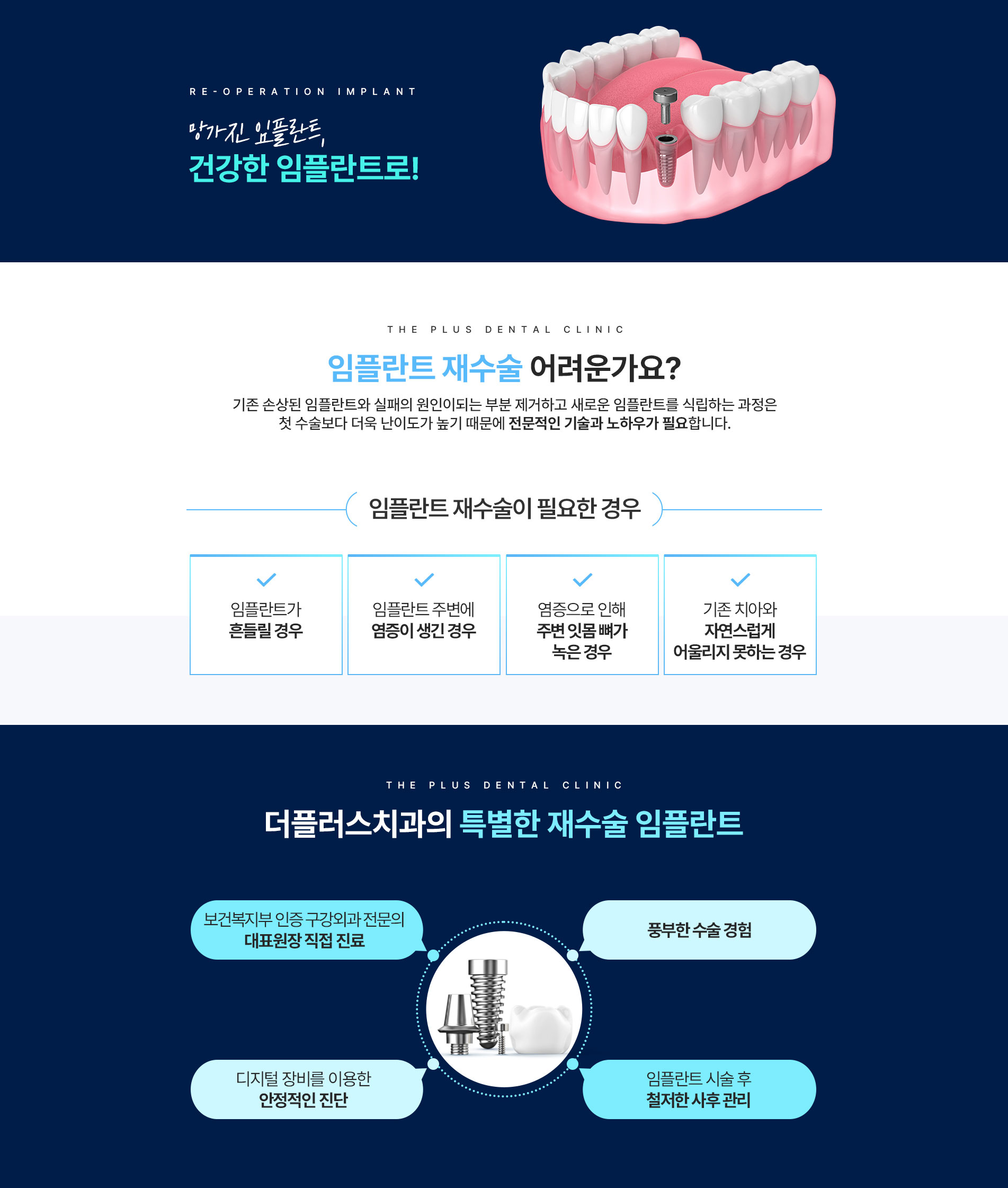 재수술임플란트