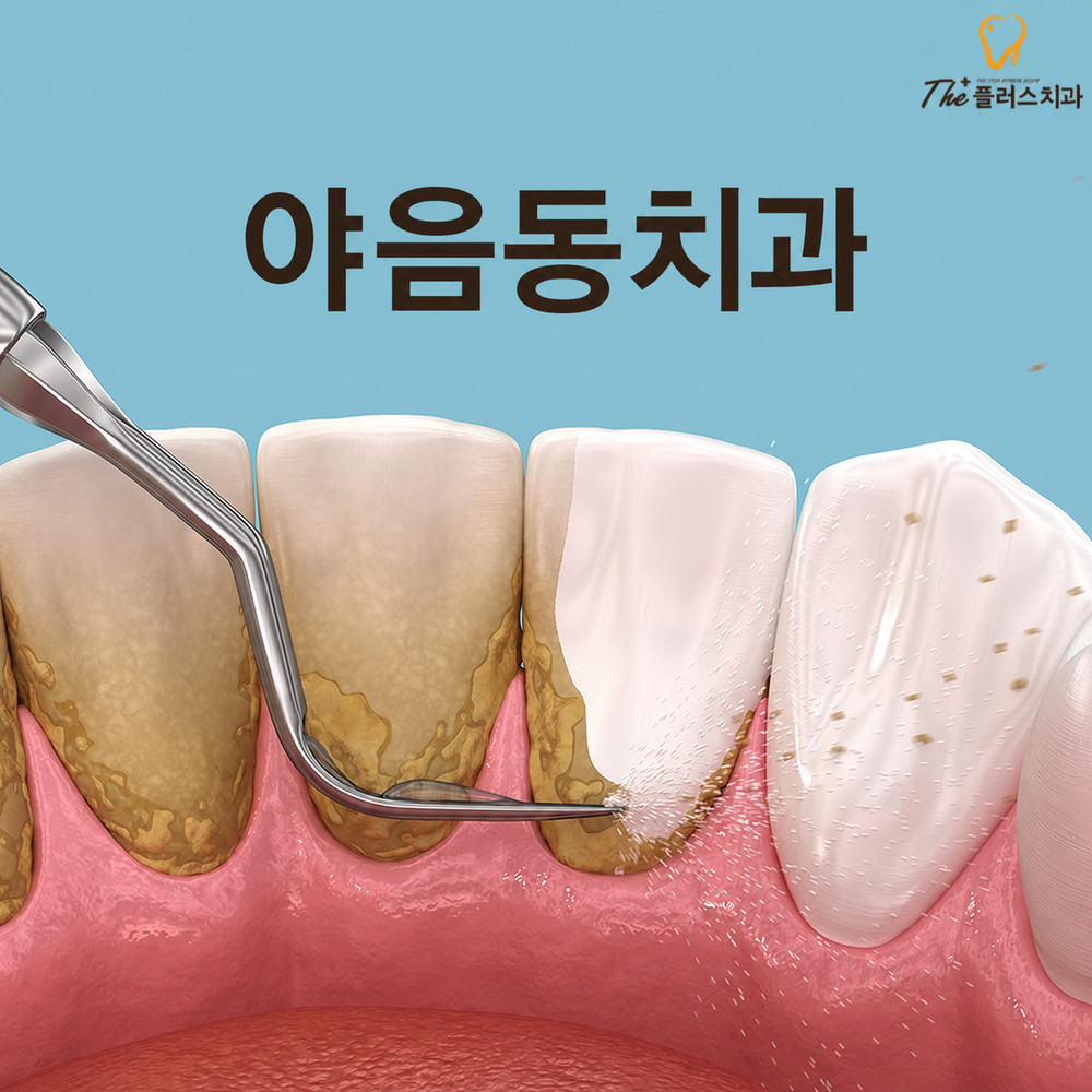 잇몸이 간질거릴 때 확인하는 야음동치과 구강 상태
