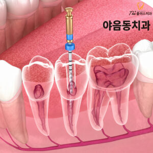 yaeum-dong-root-canal-1