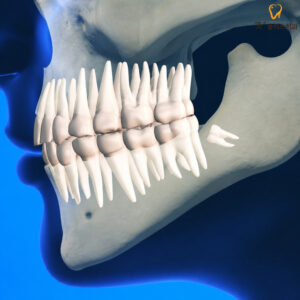 yaeum-dong-wisdom-tooth-1