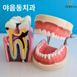 yaeum-dong-cavity-treatment-1