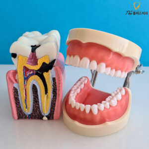 yaeum-dong-dental-cavity-treatment-1